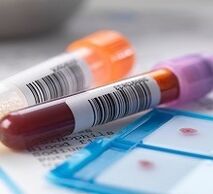 A prosztatitisz laboratóriumi diagnosztizálása